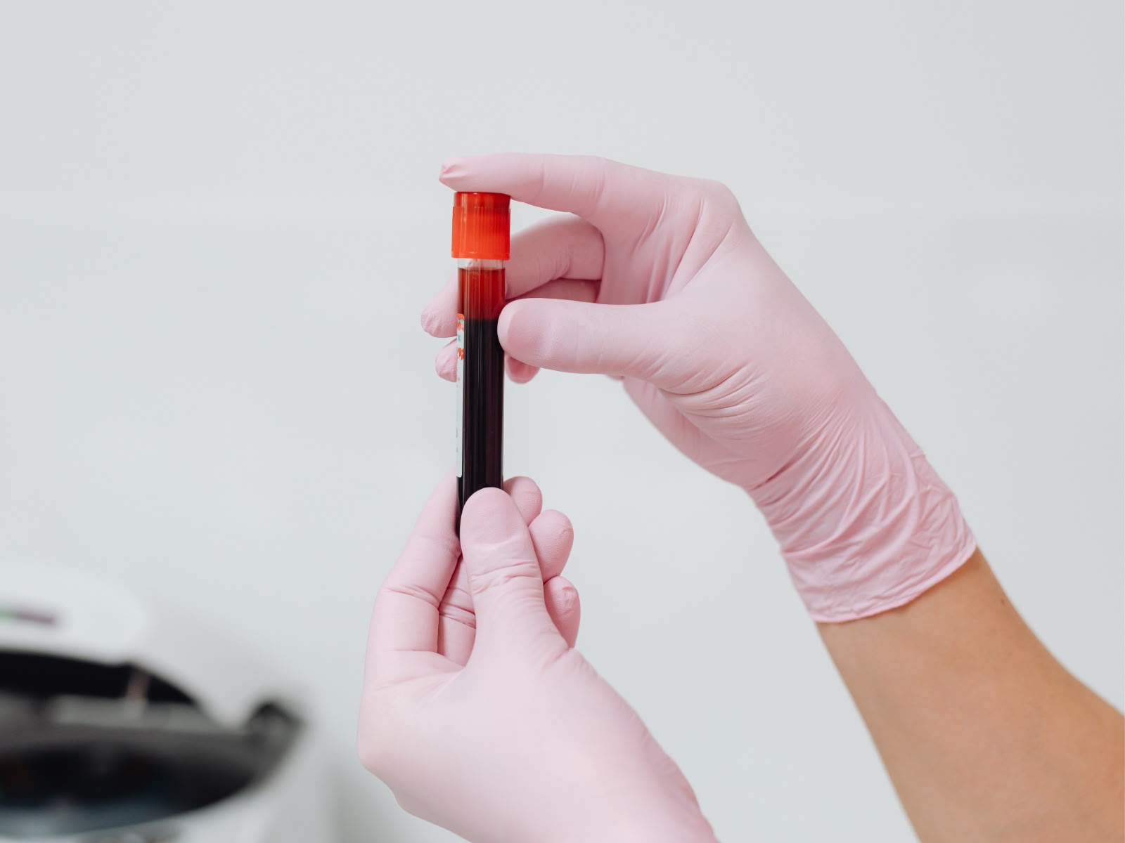 Incidência entre os homens com leucemia é 20% maior do que entre as mulheres