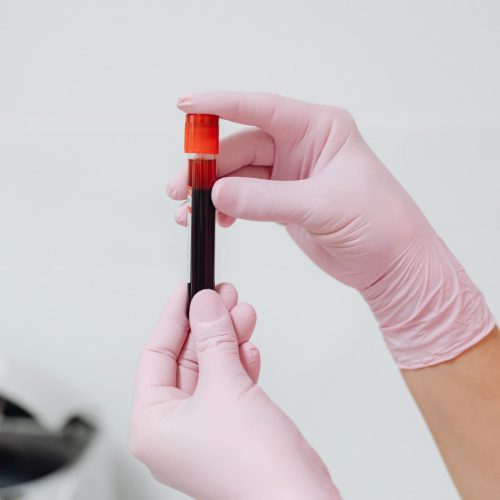 Incidência entre os homens com leucemia é 20% maior do que entre as mulheres