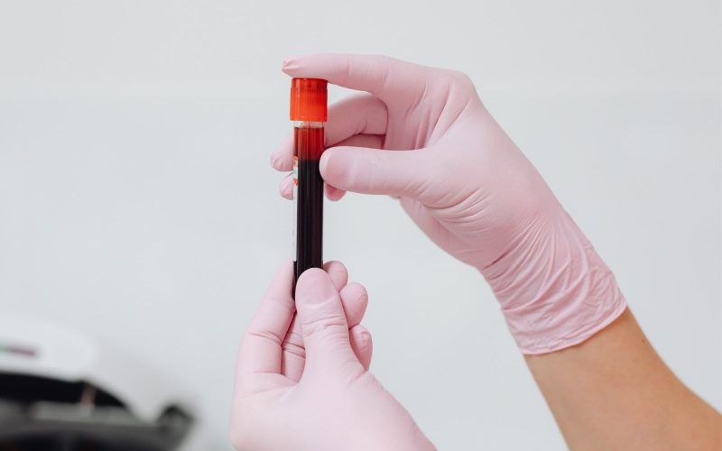 Incidência entre os homens com leucemia é 20% maior do que entre as mulheres