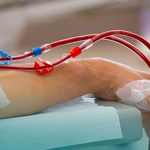 Justiça acata pedido do MP e determina que Prefeitura de Iguatu garanta atendimento a pacientes em hemodiálise